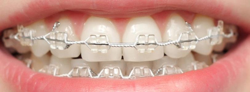 Ankara Ortodonti Doktorları